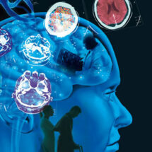 Test de sangre podría detectar Esclerosis Múltiple años antes de presentar síntomas.