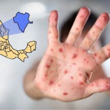 Brote de sarampión en Durango alcanza 185 casos; intensifican vacunación