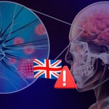 Brote de meningitis en Canterbury deja dos muertos y 29 casos entre estudiantes